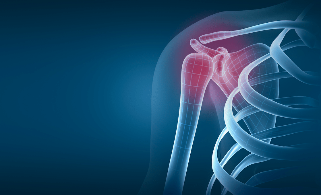 Shoulder Arthritis - Orthopedic AssociatesBlog | Denver Top Surgeons ...