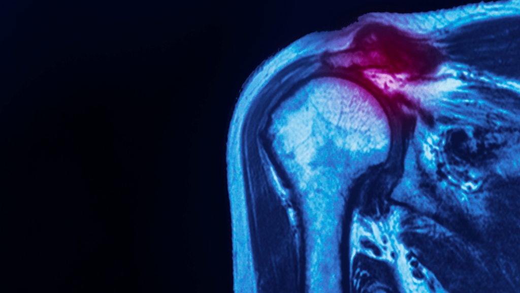 Screen Shot 2020 01 09 at 8.59.45 AM 1030x580 1