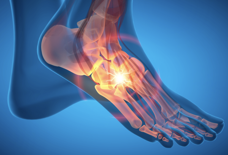 Image | Denver Surgeon Orthopedic Top Doctors Foot Ankle Hip